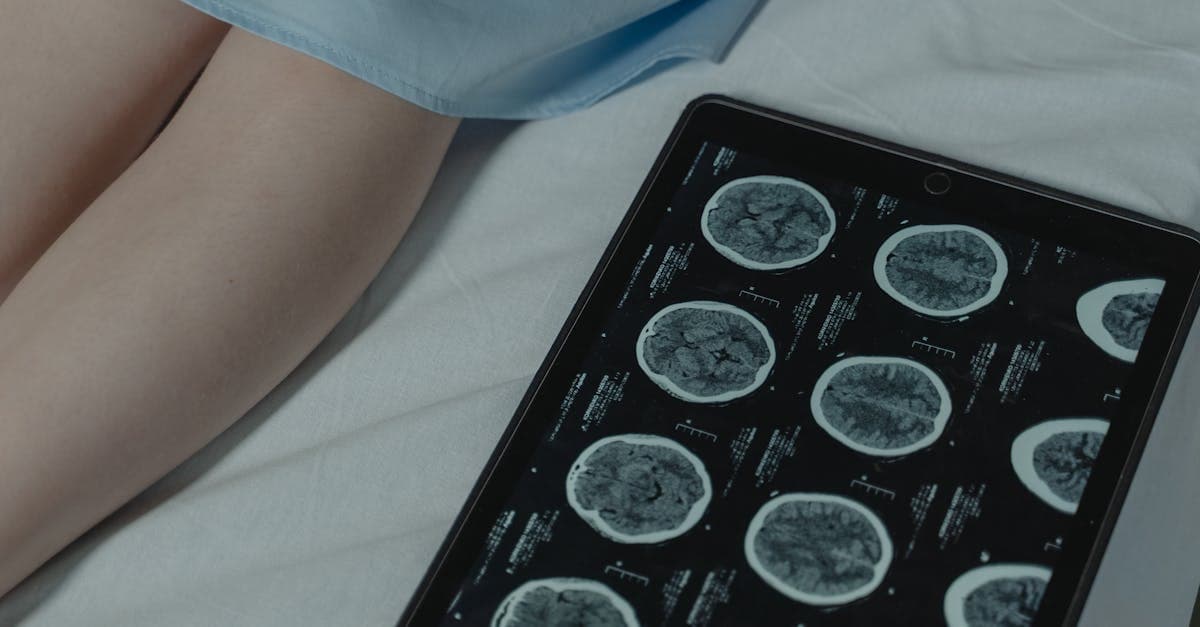 Capire i test citogenetici per il cancro: Diagnosi, trattamenti e scoperte
